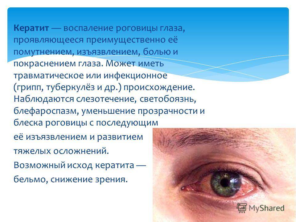 Конъюнктивит при орви и простуде у взрослых: причины и лечение глаз после заболевания