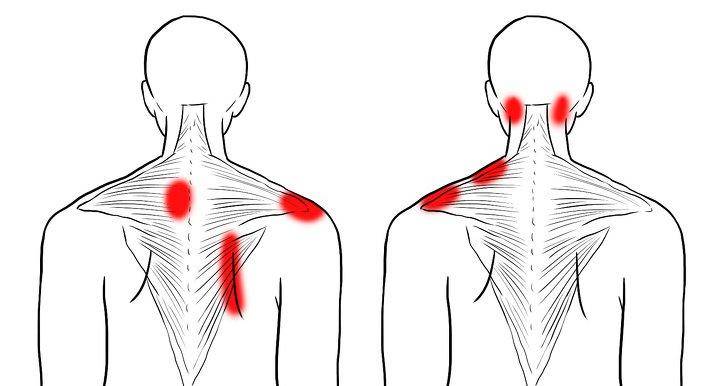 Как добиться расслабления мышц шеи и верхней части спины