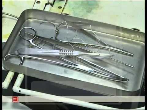 Хирургическая стерилизация (лишения способности к воспроизводству потомства)