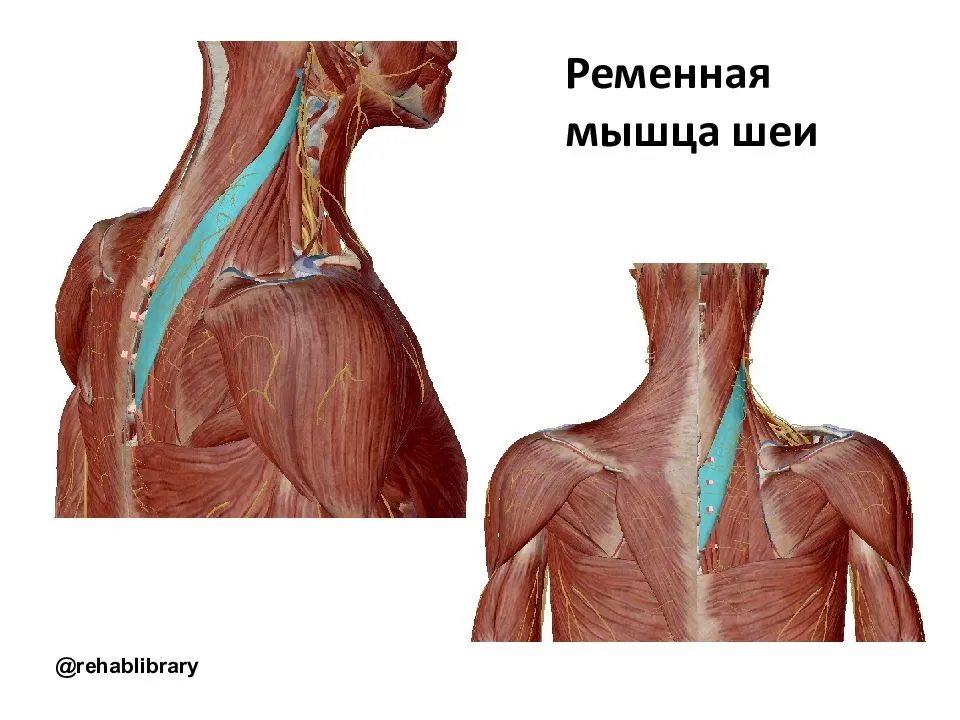 Головные боли при остеохондрозе шейного отдела: причины, симптомы, лечение