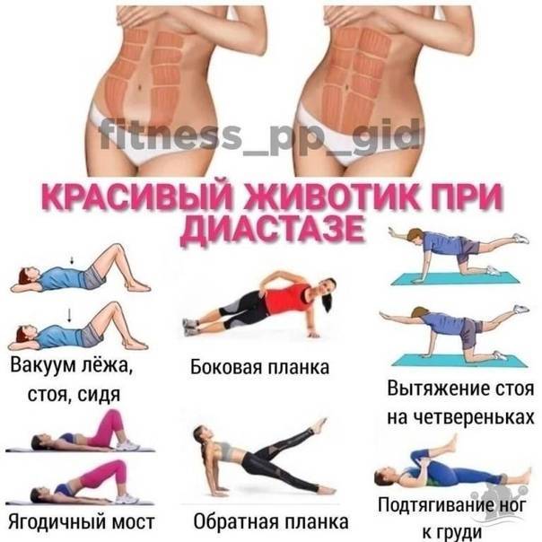 Как убрать растяжки