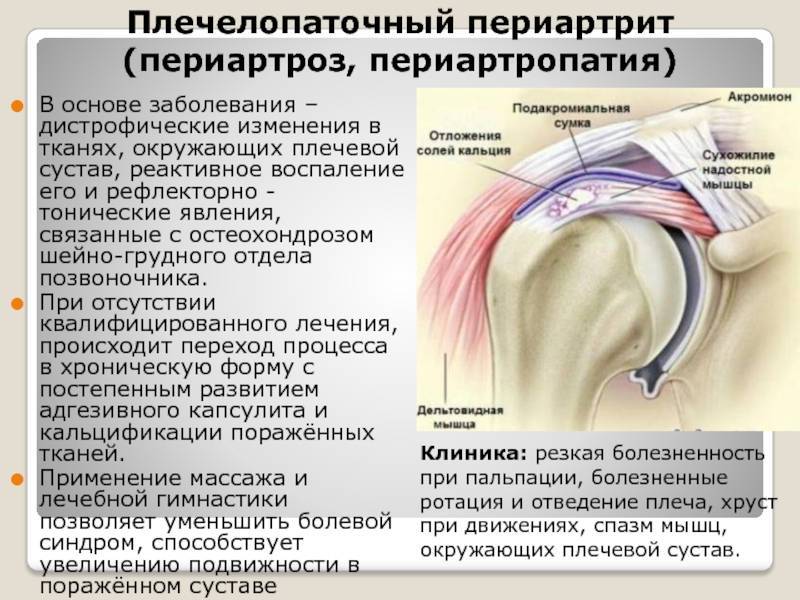Боль в плече и шее: причины и лечение