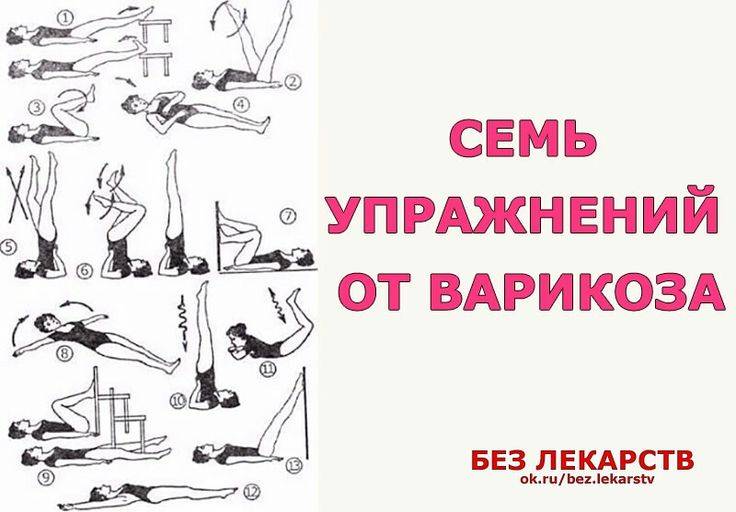 Спорт при варикозе