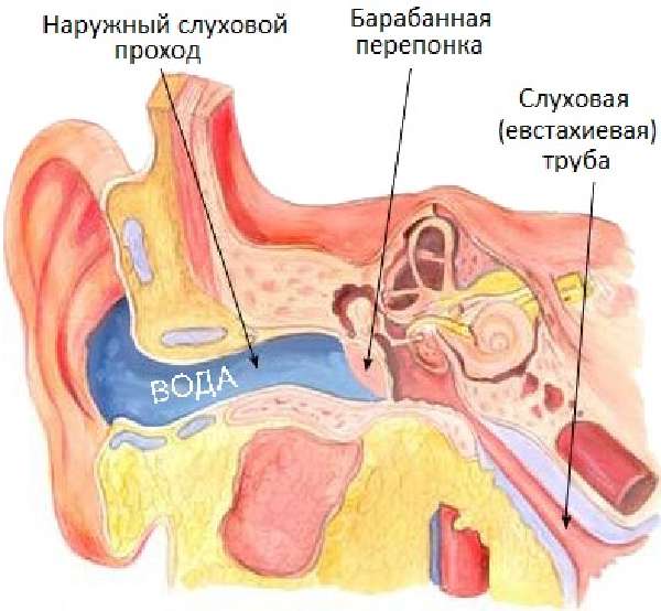 Причины евстахиита. лечение туботита в москве