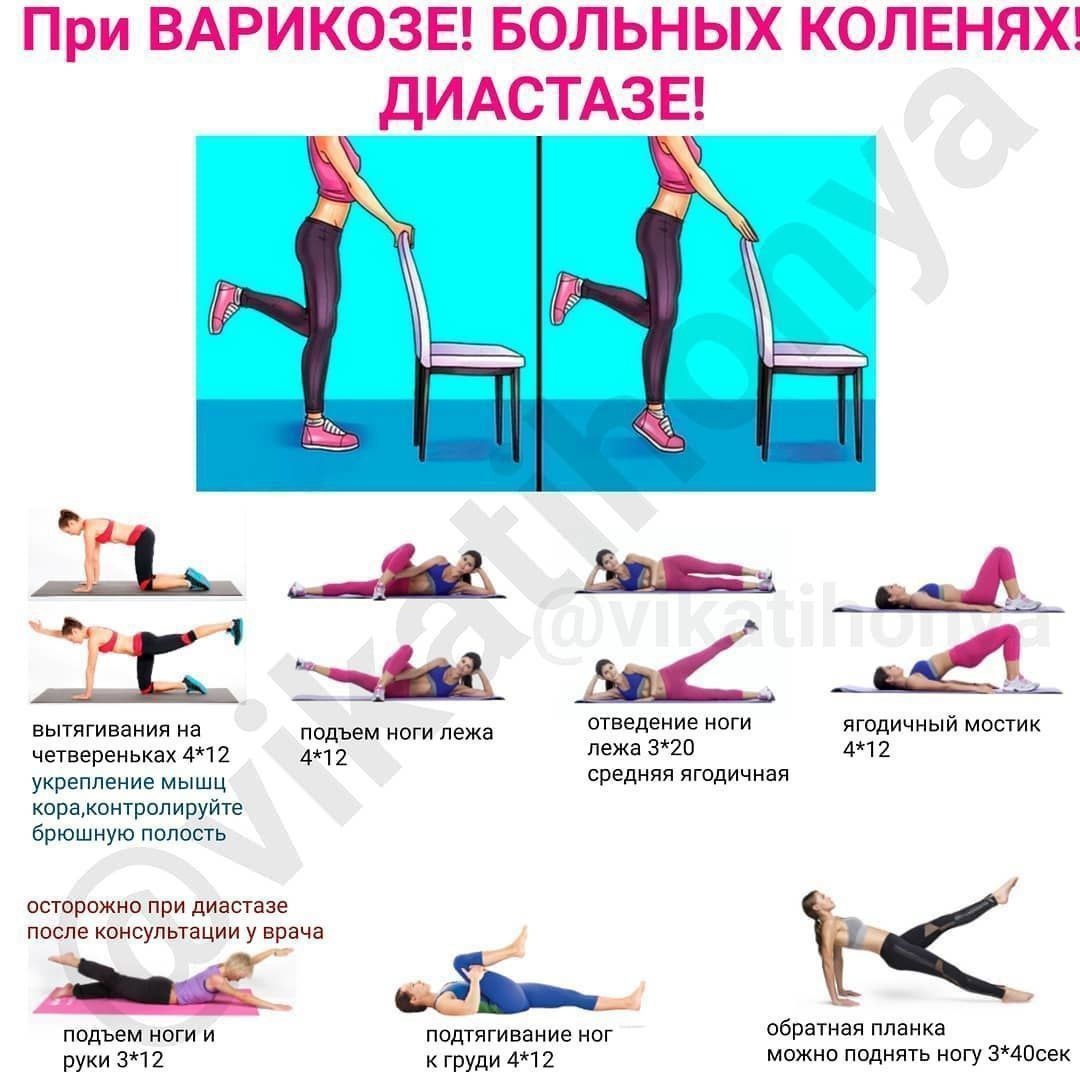Какие упражнения нельзя делать при варикозе ног, а какие будут полезны? - tony.ru