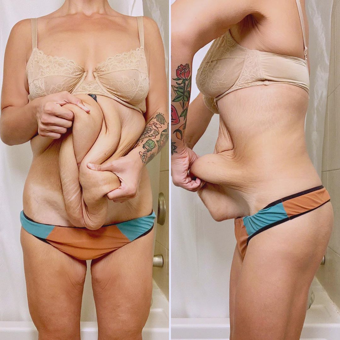 уменьшилась грудь после беременности фото 16