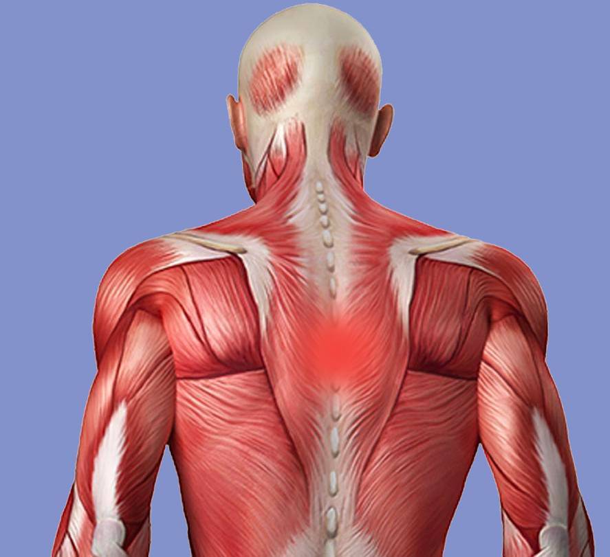 Боль в середины спины: причины болей в грудном отделе позвоночника | ким
