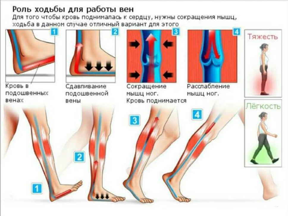 Варикоз вен на ногах – симптомы, признаки, лечение, что можно и что нельзя при варикозе