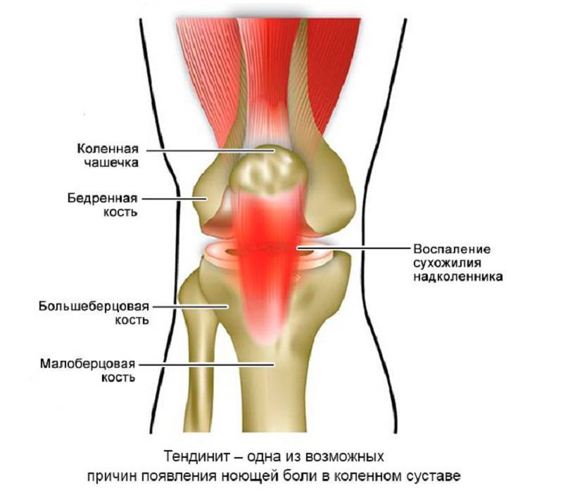 Боли в мышцах и в суставах по всему телу - причины и лечение