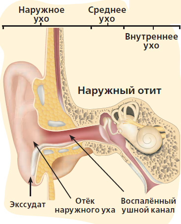Как извлечь воду из уха: 13 шагов (с иллюстрациями)