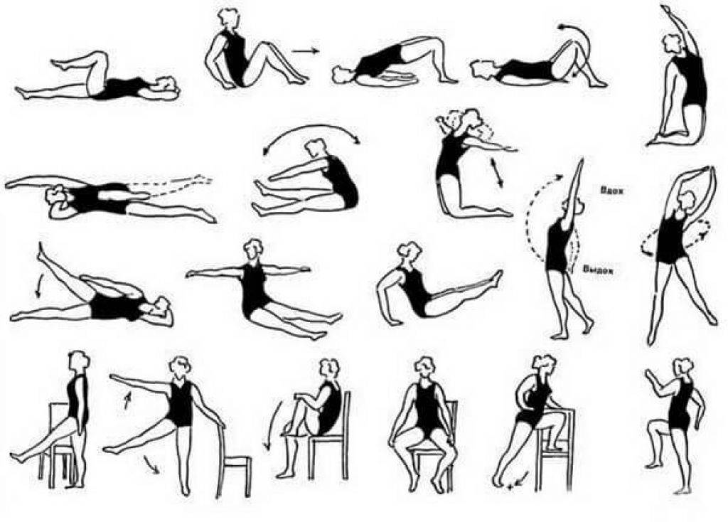 Лечебная гимнастика и упражнения при ректоцеле