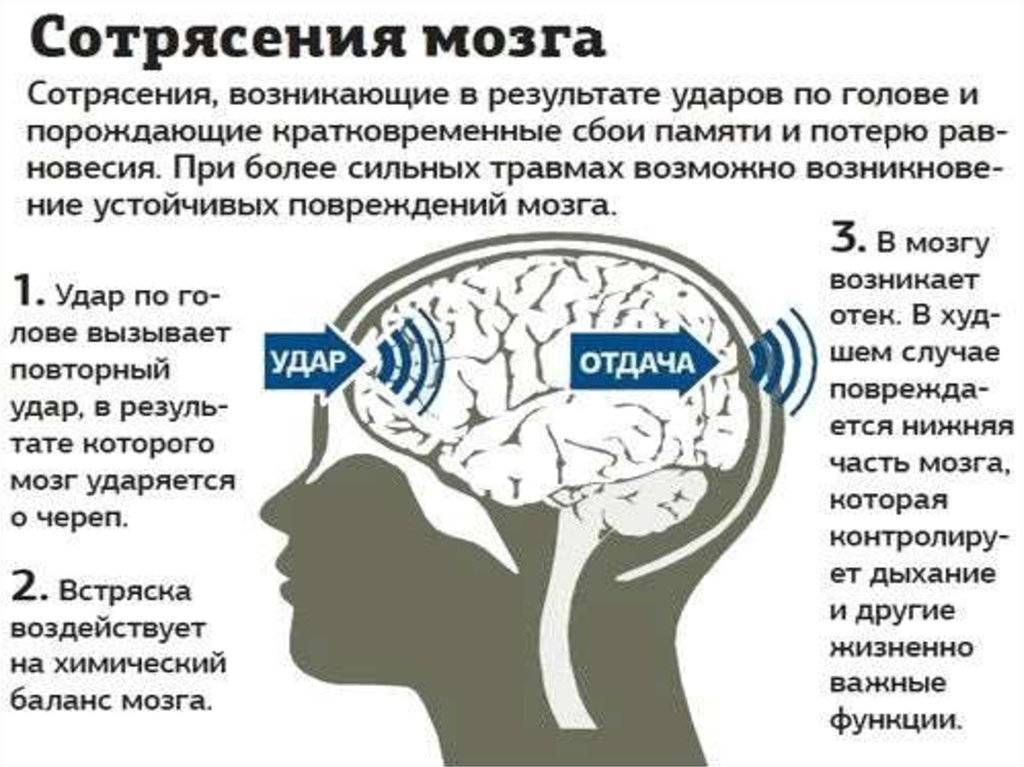 Сотрясение мозга - медицинский центр «эхинацея»