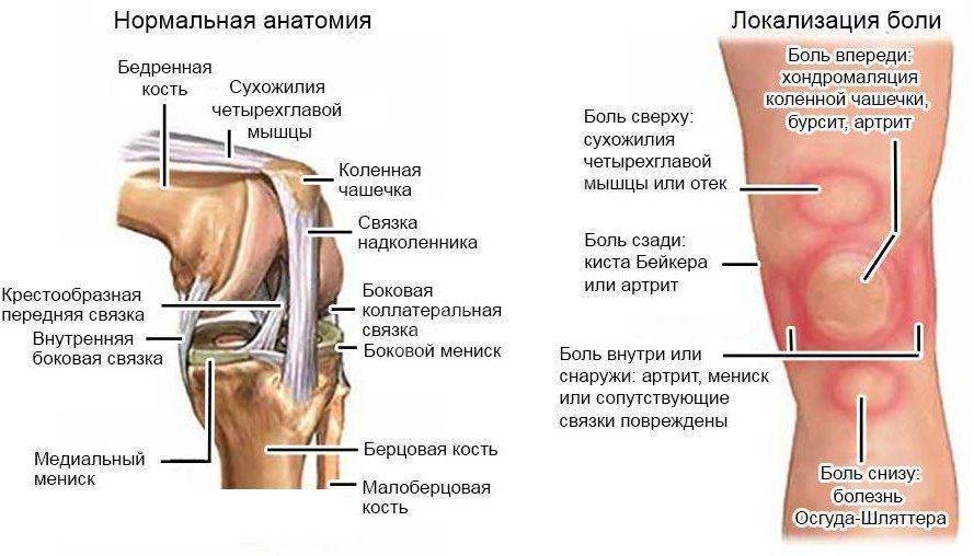 Боль в колене: подсечка от болезни