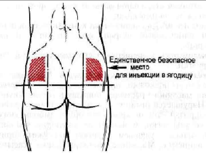 Можно ли поставить укол ребенку безопасно и комфортно?
