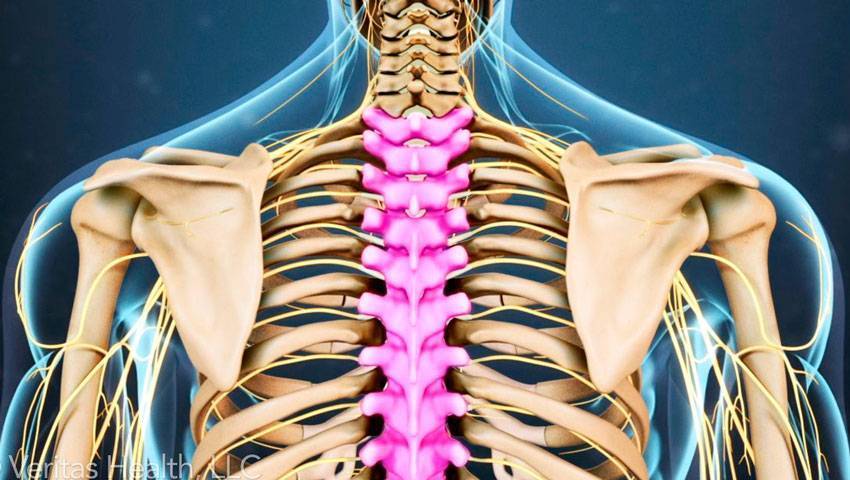 Что делать при защемлении нерва в спине, как лечить, профилактика